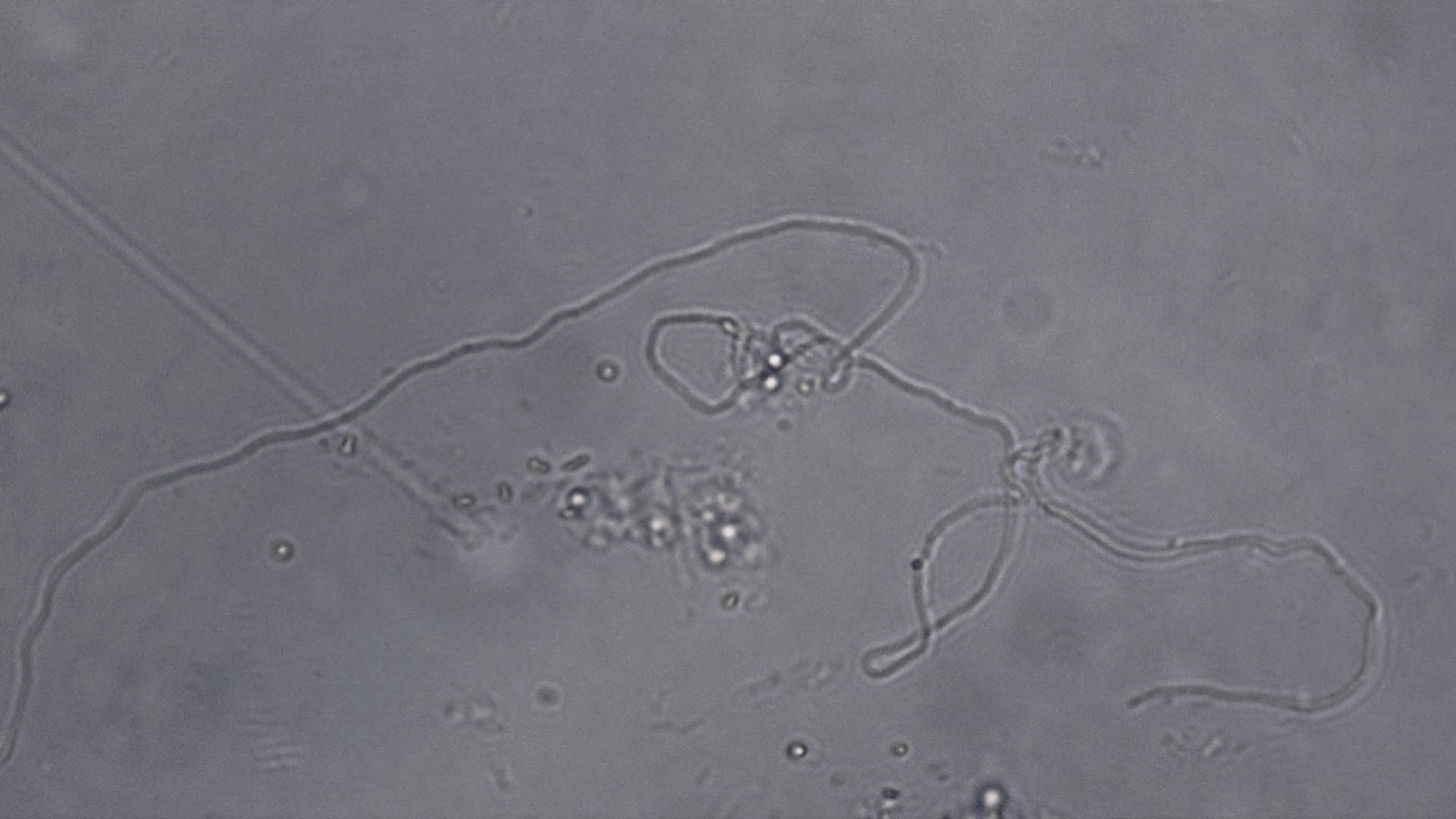 Actinomycetes filaments