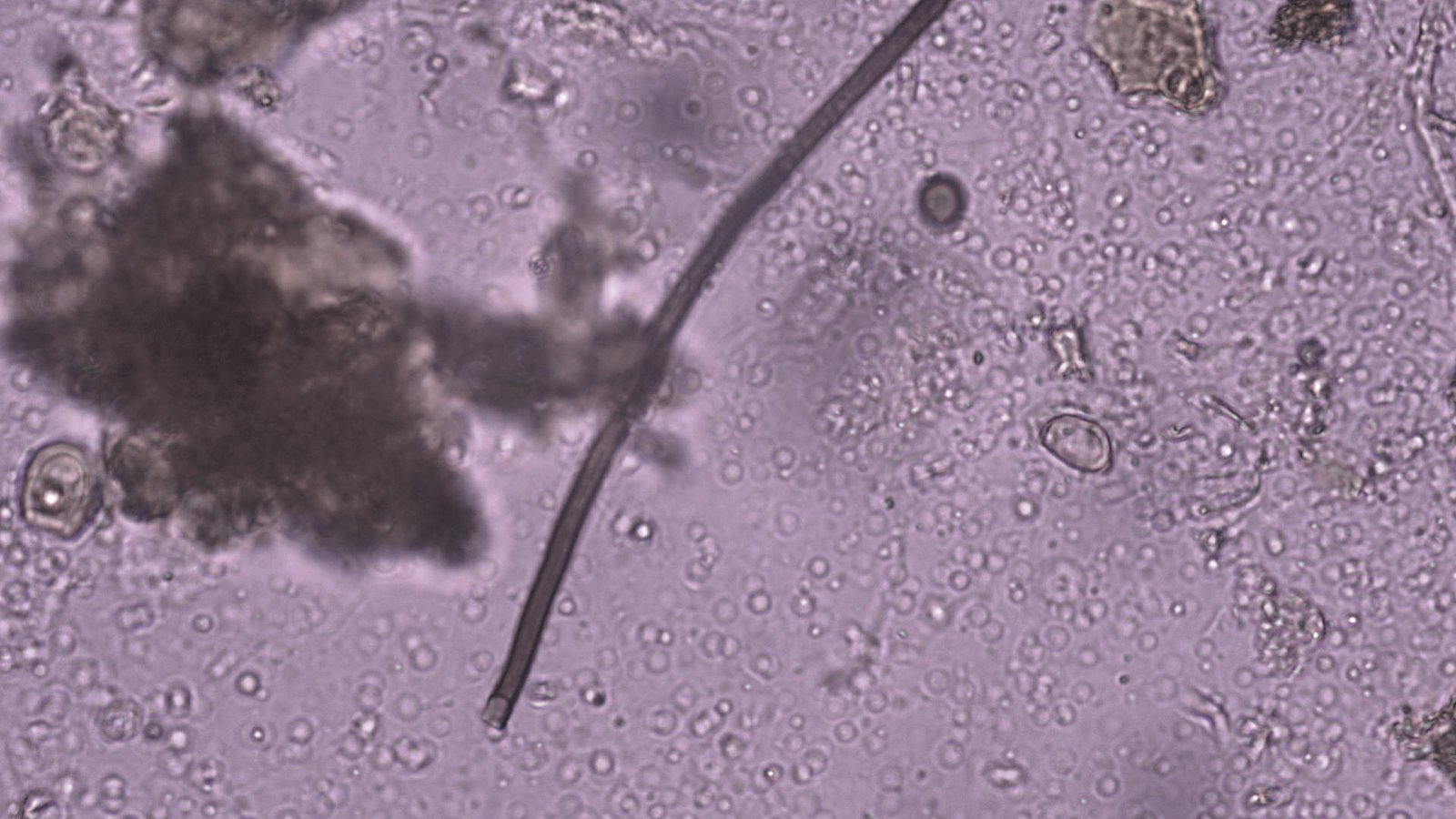 Active bacteria and fungi